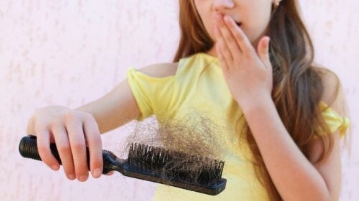 ¿Se le cae el cabello a tu hijo ? Conoce las razones por las que se produce la alopecia infantil