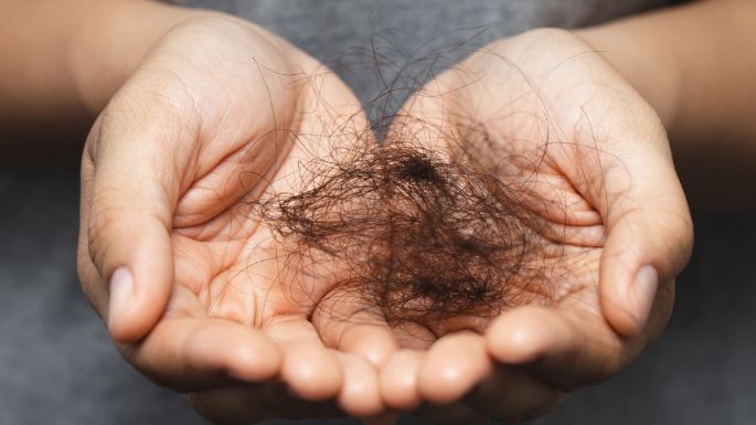 ¿Calvicie por nervios? Descubre qué es la alopecia nerviosa y qué la provoca