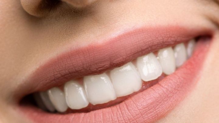¿Placa bacteriana en dientes? Sigue estos consejos para que ya no aparezca más
