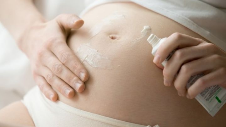 ¿Estrías por el embarazo? Estos son algunos consejos para aliviar la molesta comezón