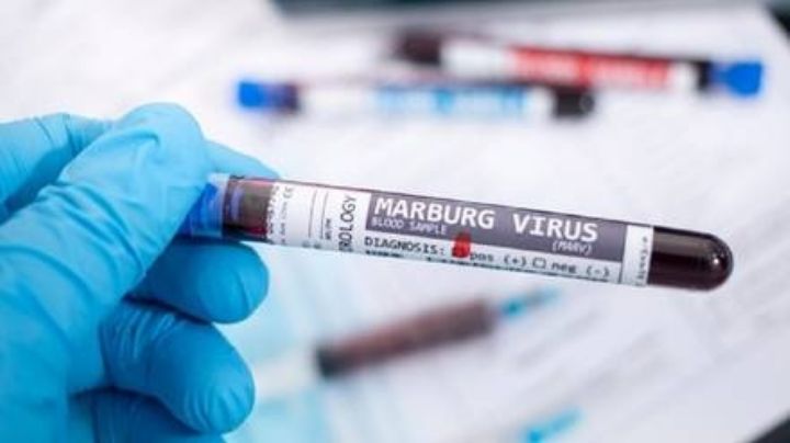 Conoce todo sobre el virus de Marburgo, la enfermedad que ha despertado pánico mundial