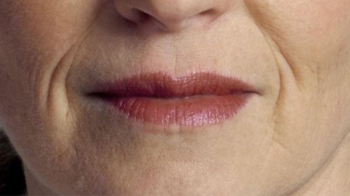 Arrugas en la boca: Remedios naturales para hacerlas desaparecer