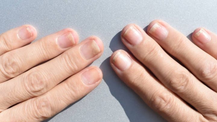 Uñas dañadas: Algunos consejos útiles para mejorar su aspecto