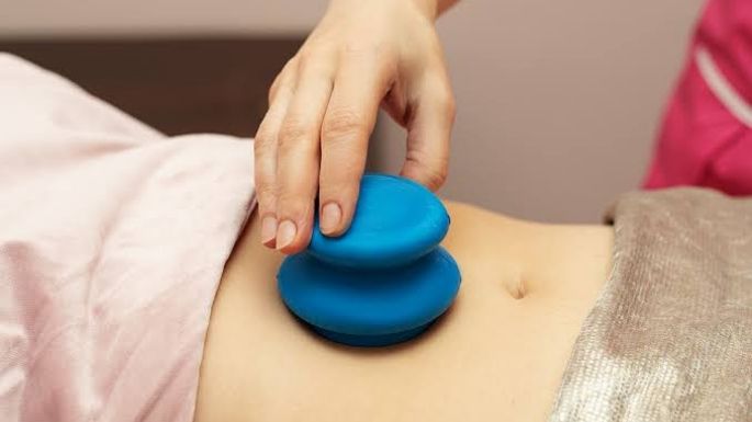 Ventosas anticelulitis: ¿Ya conoces este tratamiento eficaz para desaparecerlas?