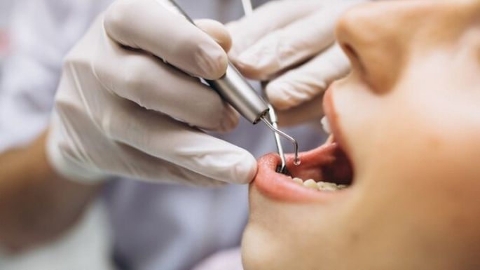 5 beneficios de visitar al dentista una vez al mes