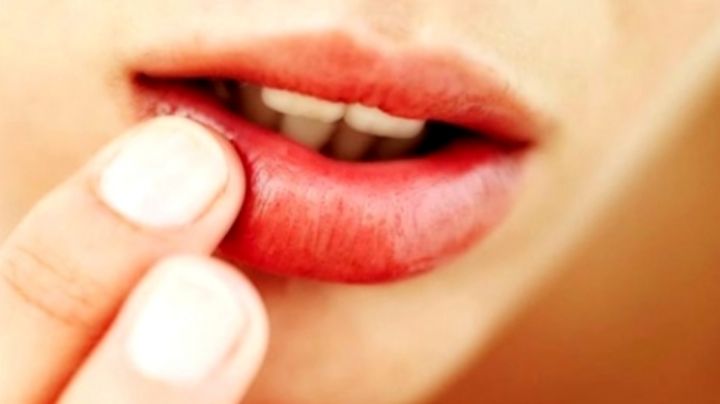 Candidiasis oral, una enfermedad común en la boca: ¿Sabes cuáles son los síntomas?