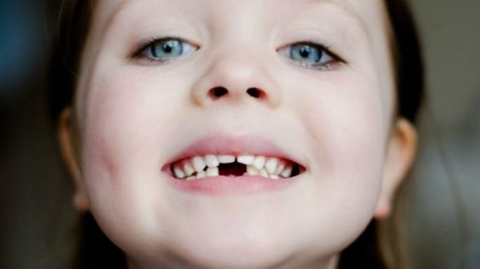 ¿Aún no lo crecen algunos dientes? Descubre qué es la agenesia dental en niños