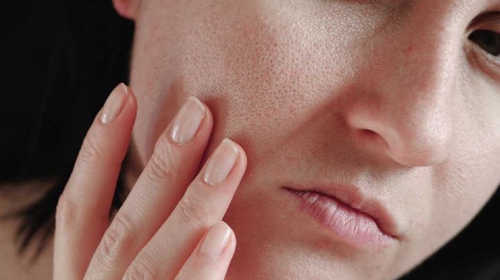 5 consejos para tratar la piel cuando esta deshidratada