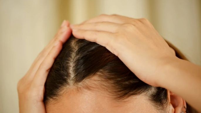 ¿Cuero cabelludo sensible? Aprende a tratar esta afección de la piel