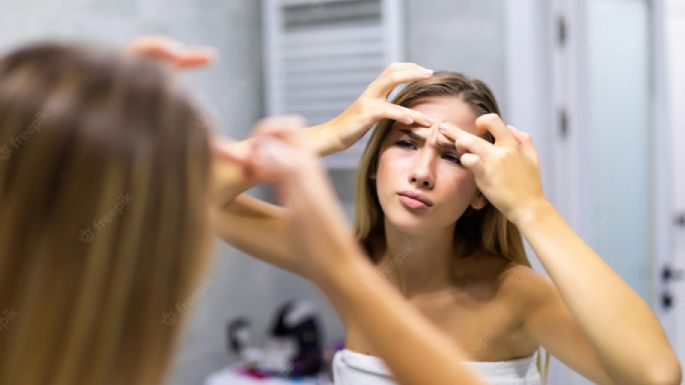 ¿Tienes puntos blancos? Aquí te compartimos una pequeña guía para eliminarlos