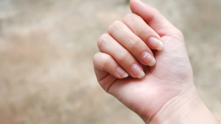 ¿Manchas blancas en las uñas? Te contamos por qué salen y cómo prevenirlas