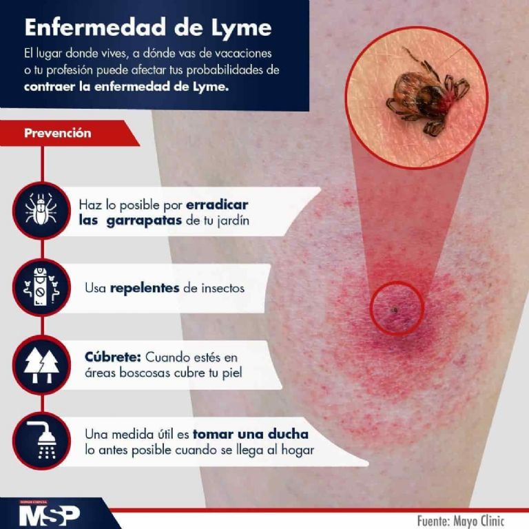 La enfermedad de Lyme se transmite por la picadura de una garrapata 