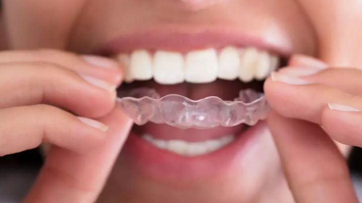 Apretar los dientes es señal de ansiedad; así puedes tratar este problema