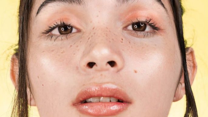 ¿Quieres tener pecas? 3 técnicas que te ayudarán a lograrlo