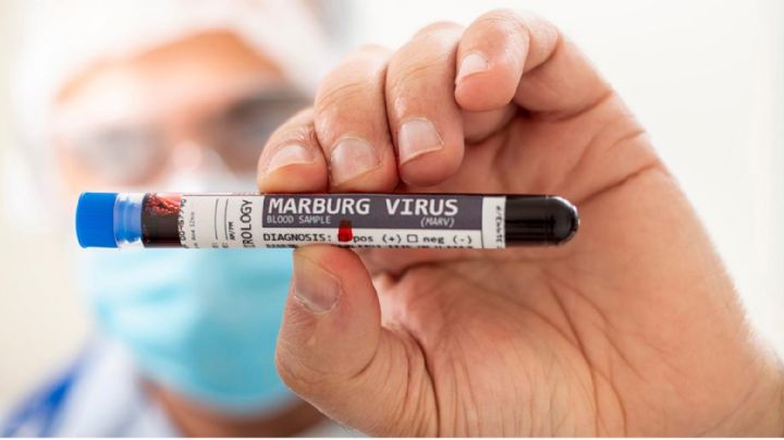 Virus de Marburgo: Síntomas que debes atender inmediatamente para protegerte