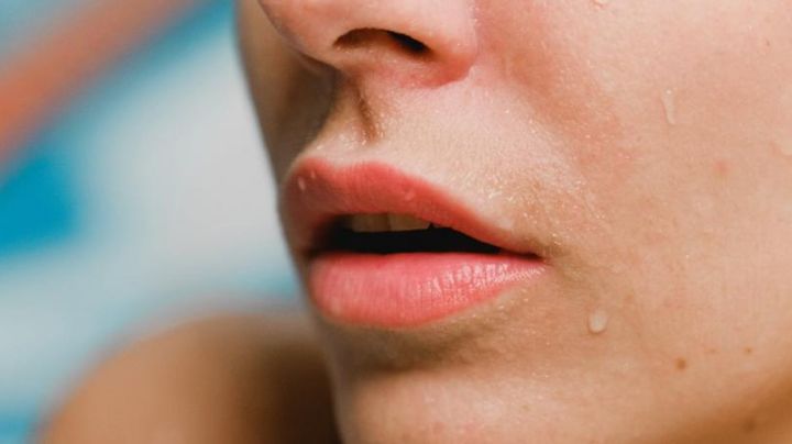 Quemaduras solares en los labios: ¿Cómo reconocerlas y de qué forma tratarlas?