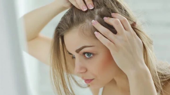 ¿Se te cae el cabello? Esto puede ser señal de estrés; conoce todos los daños