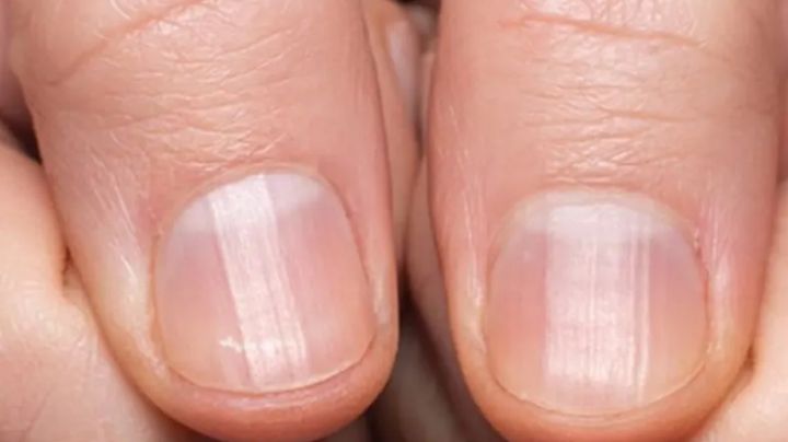 ¿Cómo reparar las uñas quebradizas? Sigue esta guía paso a paso