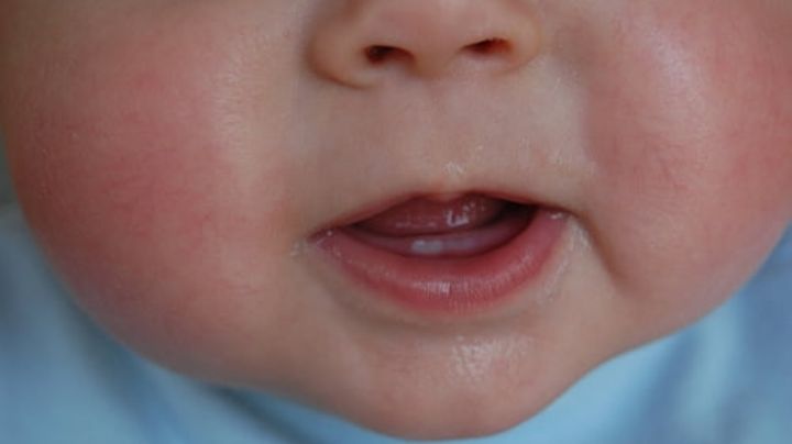 Dentición: Estos son los síntomas a reconocer en los bebés