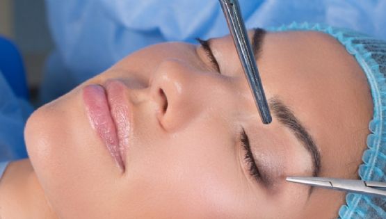 Blefaroplastia: ¿Cuáles son los riesgos de esta cirugía de párpados?