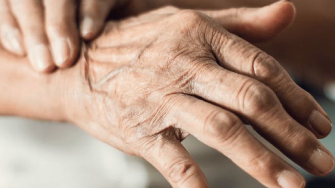 Día Mundial del Parkinson: Esto es todo lo que hasta el día de hoy se conoce sobre esta enfermedad