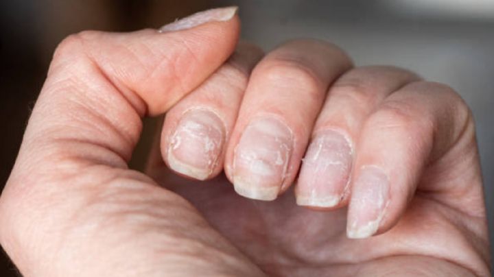 ¡Ten cuidado! Si tus uñas crecen demasiado rápido podrías padecer algunas enfermedades graves
