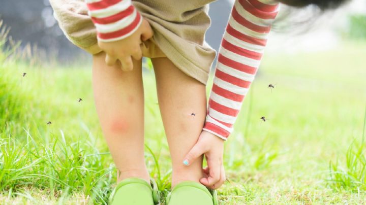 2 remedios naturales para aliviar la comezón e hinchazón de una picadura de mosquito en niños