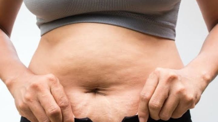 ¿Cuáles son las causas de la celulitis en el vientre? Además, te enseñamos cómo difuminarlas