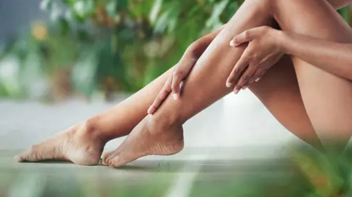 Alivia los síntomas de las várices con estos remedios caseros; olvídate de las piernas pesadas