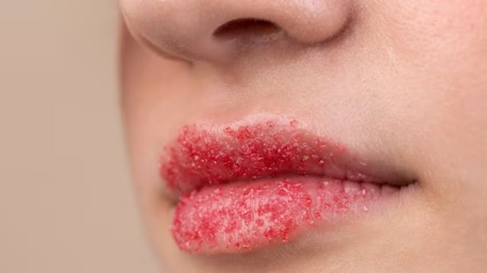 Encuentra aquí los exfoliantes labiales caseros más efectivos; dan resultados sorprendentes