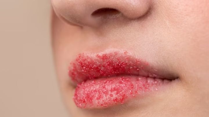 Encuentra aquí los exfoliantes labiales caseros más efectivos; dan resultados sorprendentes