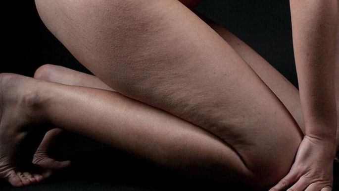 Deshazte de la celulitis en los muslos de forma natural; sigue estos remedios caseros y efectivos