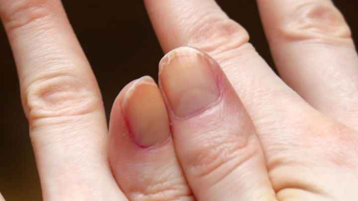 Por estos motivos es que tus uñas se han vuelto amarillas; conoce las causas para combatirlas