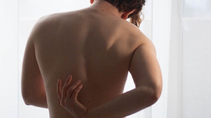 Adiós al acné de espalda: Tratamientos que funcionan y consejos para disminuir su aparición